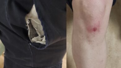 Φωτογραφία του ΟΔΟΣ εκείνων….. ΟΔΟΣ απόντων υπευθύνων….